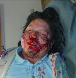 Comunero herido a bala