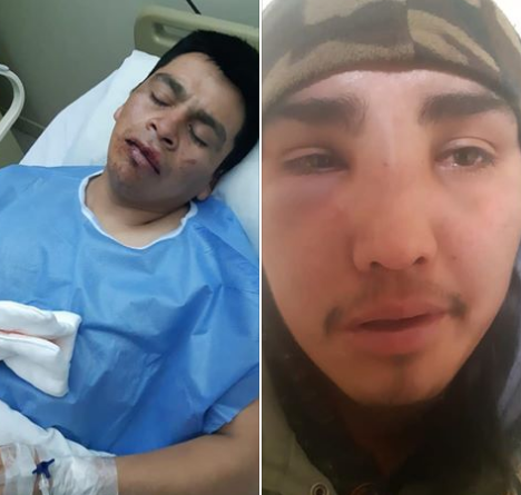 Presentan querella contra atacantes de mapuche en fundo Santa Adela y hospital de Victoria
