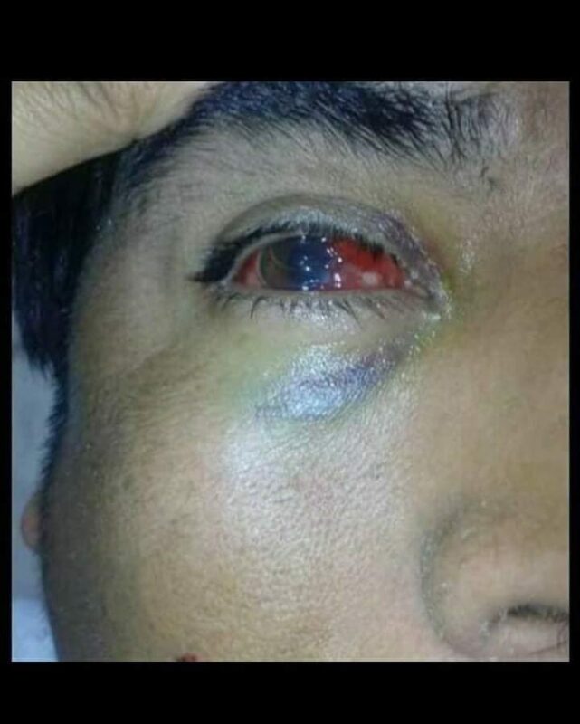 Collipulli: Prisión preventiva para militares formalizados por torturas a werken del Lof Txen Txen Mawida